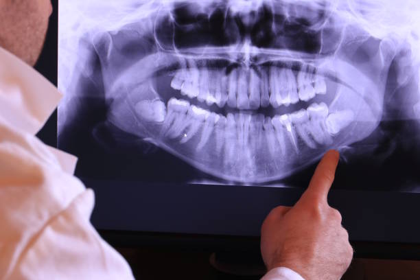 Best Emergency Treatment for Toothache in Larch Y, WA
