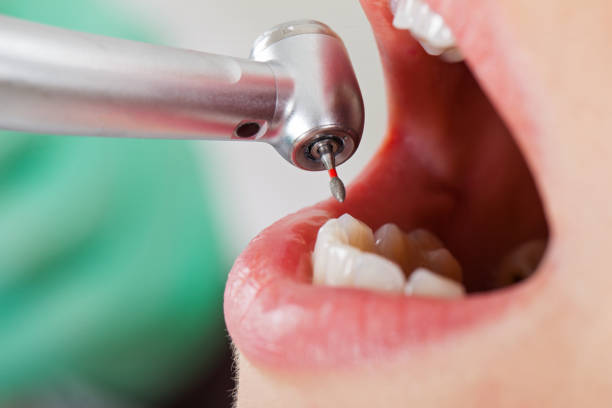 Best Pediatric Emergency Dentist in Larch Y, WA